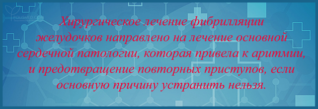 хирургическое лечение фибриляции желудочков