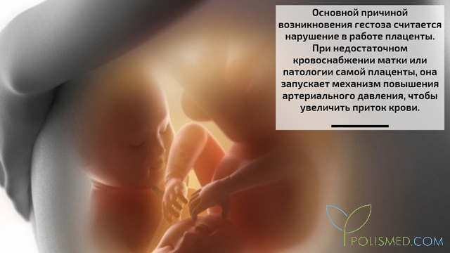 Гестоз беременных что это значит. gestozber2. Гестоз беременных что это значит фото. Гестоз беременных что это значит-gestozber2. картинка Гестоз беременных что это значит. картинка gestozber2. Гестоз (поздние токсикозы беременных, ПТГ) – патологические состояния второй половины беременности, характеризующиеся триадой основных симптомов: отеки (скрытые и видимые), протеинурия (наличие белка в моче), гипертензия (стойкое повышение артериального давления). Сопровождается расстройствами функций жизненно-важных систем: сердечно-сосудистой, нервной, эндокринной, гемостаза. По степени тяжести нарушений различают претоксикоз, водянку беременных, нефропатию беременных, преэклампсию и эклампсию. Могут явиться причиной материнской и детской смертности.
