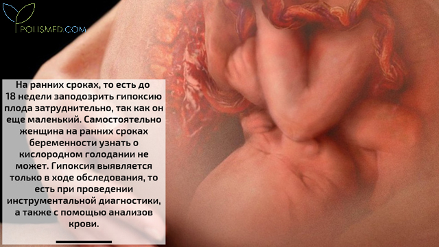 Чем опасно кислородное голодание для плода. Смотреть фото Чем опасно кислородное голодание для плода. Смотреть картинку Чем опасно кислородное голодание для плода. Картинка про Чем опасно кислородное голодание для плода. Фото Чем опасно кислородное голодание для плода