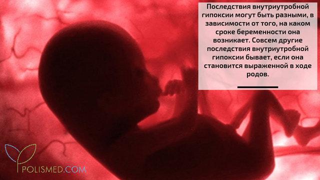 Чем опасно кислородное голодание для плода. Смотреть фото Чем опасно кислородное голодание для плода. Смотреть картинку Чем опасно кислородное голодание для плода. Картинка про Чем опасно кислородное голодание для плода. Фото Чем опасно кислородное голодание для плода