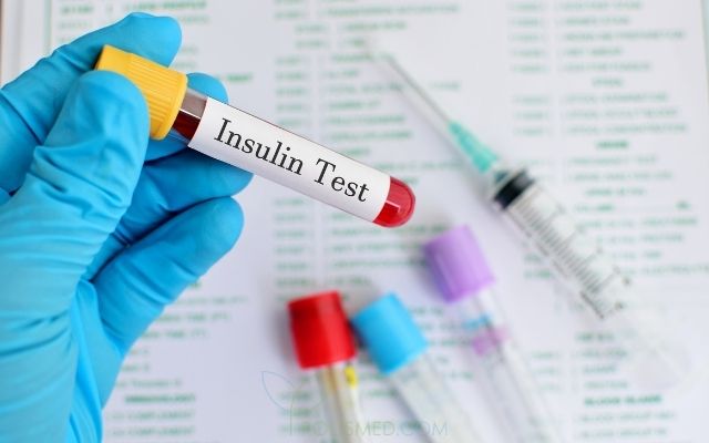 Анализ на инсулин