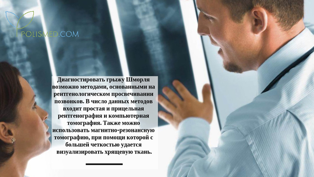 Диагностика грыжи Шморля