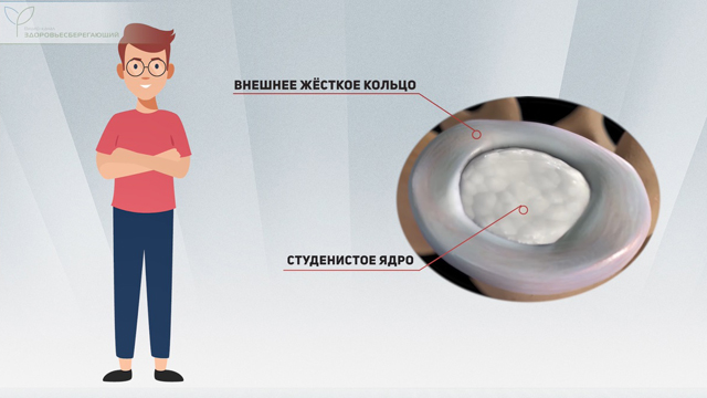 Внешнее кольцо и студенистое ядро