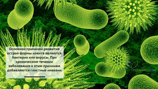 Причины илеита