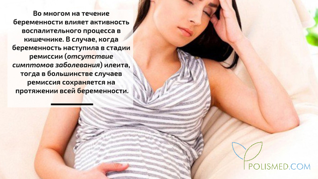 Илеит при беременности