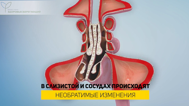 Необратимые изменения