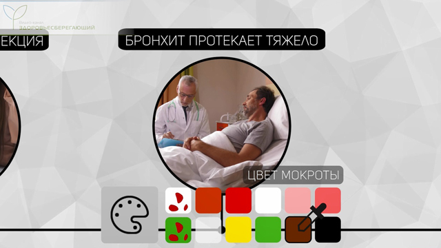 Коричневая мокрота