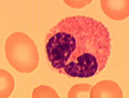 Клетки крови содержащие гемоглобин thumbnail