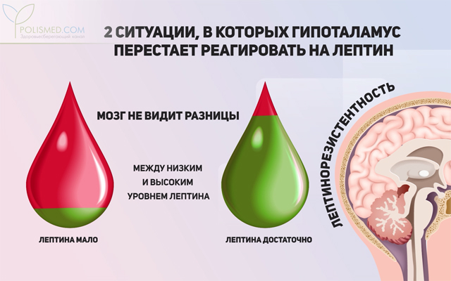 Лептинорезистентность