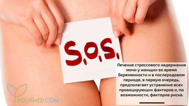 Лечение стрессового недержания мочи