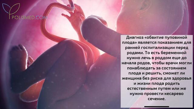 Что значит обвитие пуповины вокруг шеи плода. Смотреть фото Что значит обвитие пуповины вокруг шеи плода. Смотреть картинку Что значит обвитие пуповины вокруг шеи плода. Картинка про Что значит обвитие пуповины вокруг шеи плода. Фото Что значит обвитие пуповины вокруг шеи плода