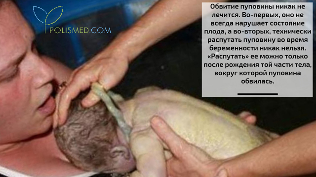 Что значит обвитие пуповины вокруг шеи плода. Смотреть фото Что значит обвитие пуповины вокруг шеи плода. Смотреть картинку Что значит обвитие пуповины вокруг шеи плода. Картинка про Что значит обвитие пуповины вокруг шеи плода. Фото Что значит обвитие пуповины вокруг шеи плода
