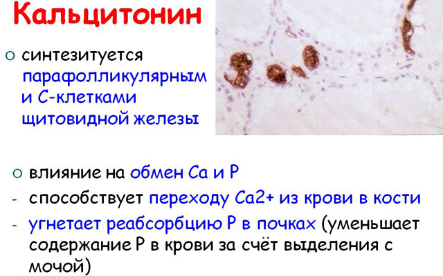 Что такое онкотест и как он происходит. Смотреть фото Что такое онкотест и как он происходит. Смотреть картинку Что такое онкотест и как он происходит. Картинка про Что такое онкотест и как он происходит. Фото Что такое онкотест и как он происходит