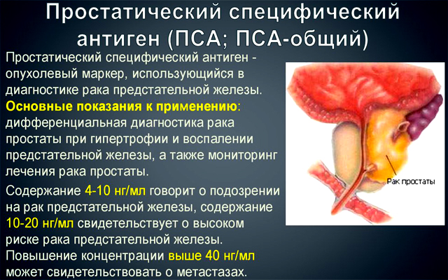 Что такое онкотест и как он происходит. Смотреть фото Что такое онкотест и как он происходит. Смотреть картинку Что такое онкотест и как он происходит. Картинка про Что такое онкотест и как он происходит. Фото Что такое онкотест и как он происходит