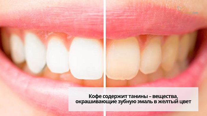 Белые и желтые зубы