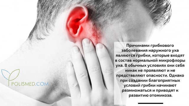 Причины отомикоза