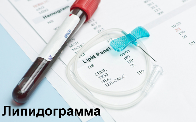 Липидограмма