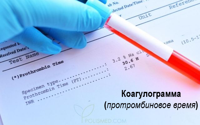 Коагулограмма