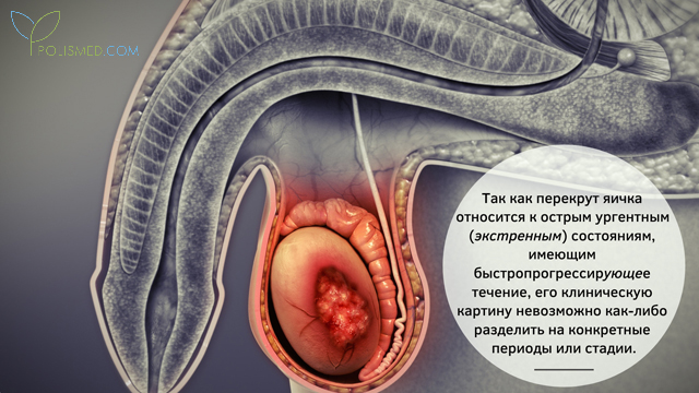 что делать если одно яйцо перекрутилось. Смотреть фото что делать если одно яйцо перекрутилось. Смотреть картинку что делать если одно яйцо перекрутилось. Картинка про что делать если одно яйцо перекрутилось. Фото что делать если одно яйцо перекрутилось