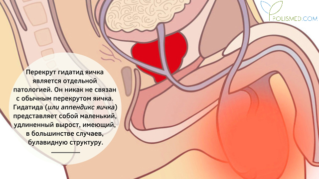 что делать если одно яйцо перекрутилось. Смотреть фото что делать если одно яйцо перекрутилось. Смотреть картинку что делать если одно яйцо перекрутилось. Картинка про что делать если одно яйцо перекрутилось. Фото что делать если одно яйцо перекрутилось