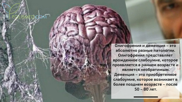 Олигофрения и деменция