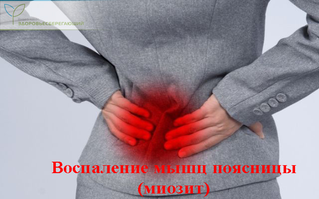 Месячные отдают в поясницу