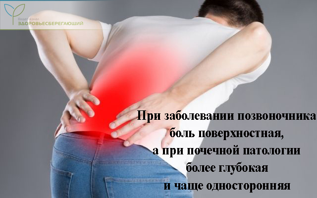 Как определить что болит спина или почки понять. Смотреть фото Как определить что болит спина или почки понять. Смотреть картинку Как определить что болит спина или почки понять. Картинка про Как определить что болит спина или почки понять. Фото Как определить что болит спина или почки понять