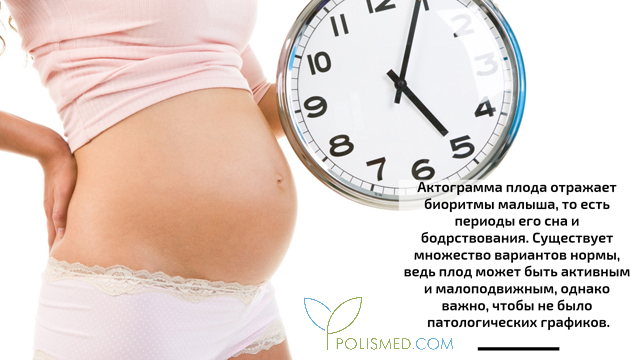 Как понять что ребенок шевелится. Смотреть фото Как понять что ребенок шевелится. Смотреть картинку Как понять что ребенок шевелится. Картинка про Как понять что ребенок шевелится. Фото Как понять что ребенок шевелится