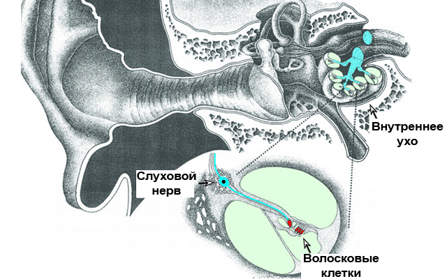 Пульсирующий звук в ухе. Волосковые клетки и слуховой нерв. Звенит в ухе. Волосковые клетки в ухе. Нерв слуховой звон в ухе.