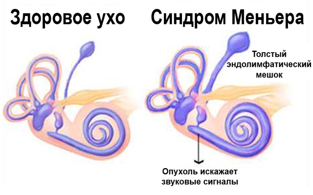 Что слышит человек в тишине. Смотреть фото Что слышит человек в тишине. Смотреть картинку Что слышит человек в тишине. Картинка про Что слышит человек в тишине. Фото Что слышит человек в тишине