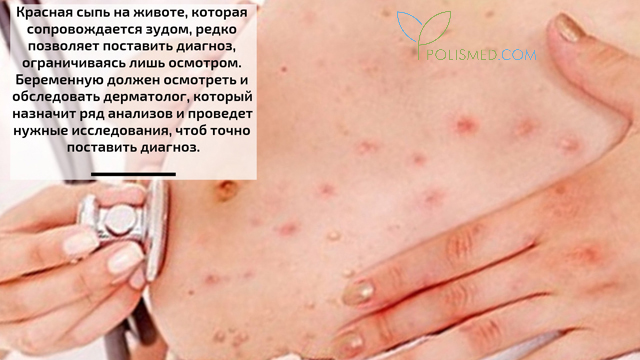 Диагностика сыпи при беременности