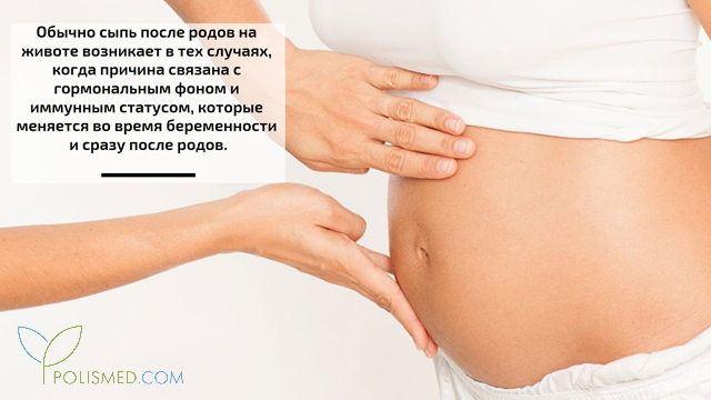 Сыпь на животе после родов