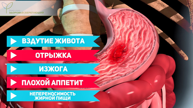 начало рвать просто так. Смотреть фото начало рвать просто так. Смотреть картинку начало рвать просто так. Картинка про начало рвать просто так. Фото начало рвать просто так