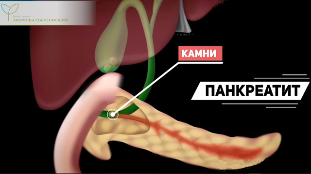 начало рвать просто так. Смотреть фото начало рвать просто так. Смотреть картинку начало рвать просто так. Картинка про начало рвать просто так. Фото начало рвать просто так