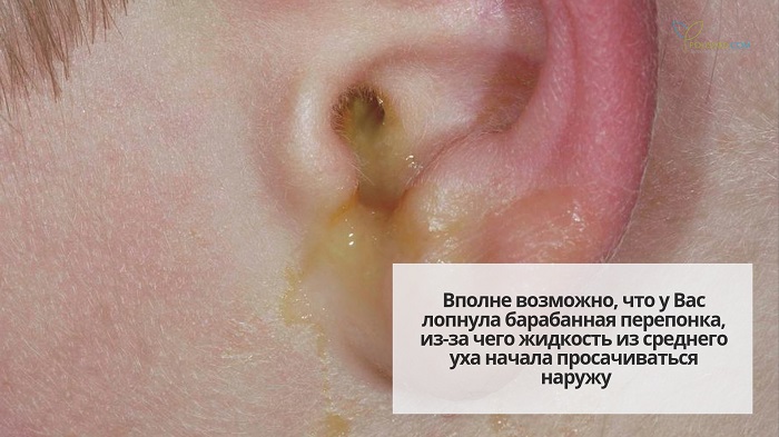 Ушная сера вытекает из уха