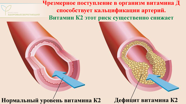 Кальций со2 что это. Смотреть фото Кальций со2 что это. Смотреть картинку Кальций со2 что это. Картинка про Кальций со2 что это. Фото Кальций со2 что это