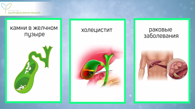 Что провоцирует холестаз?