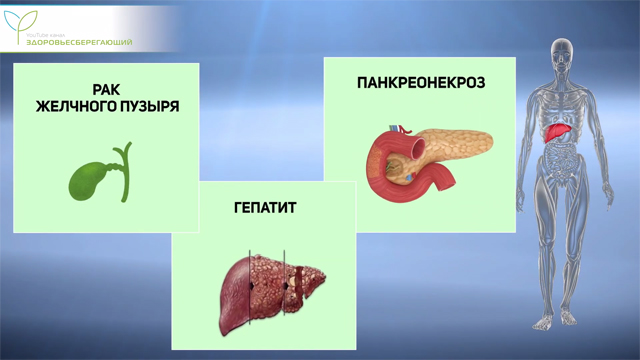 Осложнениями желчнокаменной болезни