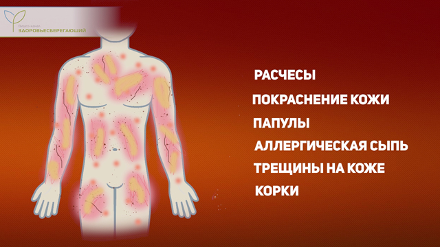 Что такое печеночная пигментация. Смотреть фото Что такое печеночная пигментация. Смотреть картинку Что такое печеночная пигментация. Картинка про Что такое печеночная пигментация. Фото Что такое печеночная пигментация