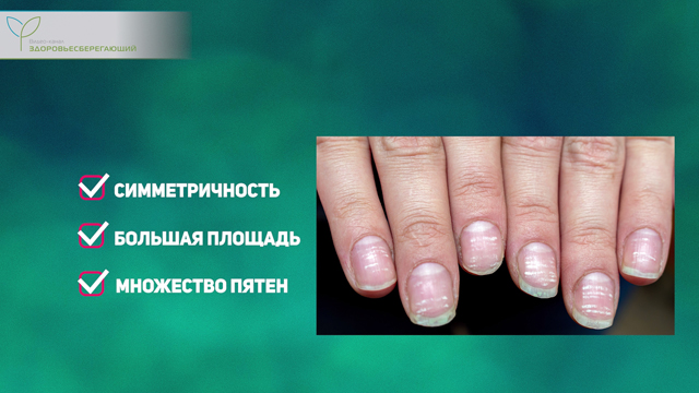 Что такое печеночная пигментация. Смотреть фото Что такое печеночная пигментация. Смотреть картинку Что такое печеночная пигментация. Картинка про Что такое печеночная пигментация. Фото Что такое печеночная пигментация