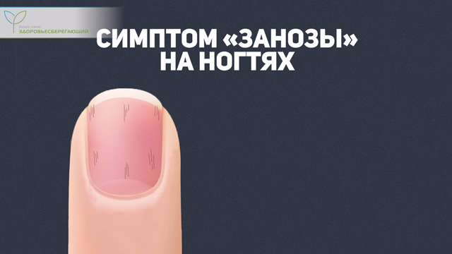 Что такое печеночная пигментация. Смотреть фото Что такое печеночная пигментация. Смотреть картинку Что такое печеночная пигментация. Картинка про Что такое печеночная пигментация. Фото Что такое печеночная пигментация