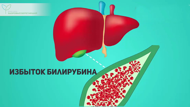 Что такое печеночная пигментация. Смотреть фото Что такое печеночная пигментация. Смотреть картинку Что такое печеночная пигментация. Картинка про Что такое печеночная пигментация. Фото Что такое печеночная пигментация