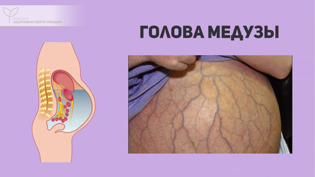 Что такое печеночная пигментация. Смотреть фото Что такое печеночная пигментация. Смотреть картинку Что такое печеночная пигментация. Картинка про Что такое печеночная пигментация. Фото Что такое печеночная пигментация