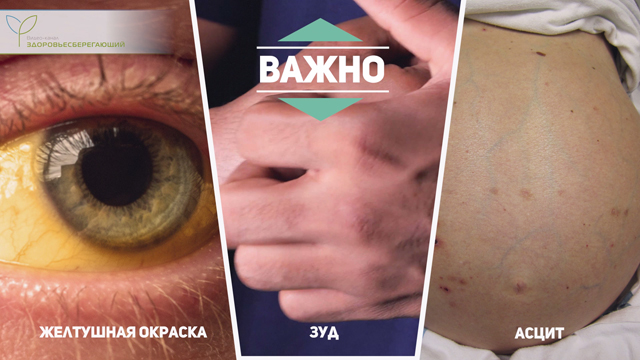 Что такое печеночная пигментация. Смотреть фото Что такое печеночная пигментация. Смотреть картинку Что такое печеночная пигментация. Картинка про Что такое печеночная пигментация. Фото Что такое печеночная пигментация
