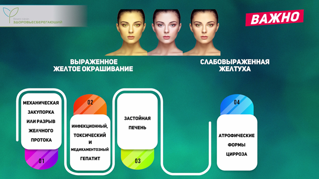 Что такое печеночная пигментация. Смотреть фото Что такое печеночная пигментация. Смотреть картинку Что такое печеночная пигментация. Картинка про Что такое печеночная пигментация. Фото Что такое печеночная пигментация