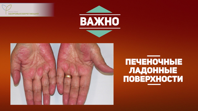 Что такое печеночная пигментация. Смотреть фото Что такое печеночная пигментация. Смотреть картинку Что такое печеночная пигментация. Картинка про Что такое печеночная пигментация. Фото Что такое печеночная пигментация