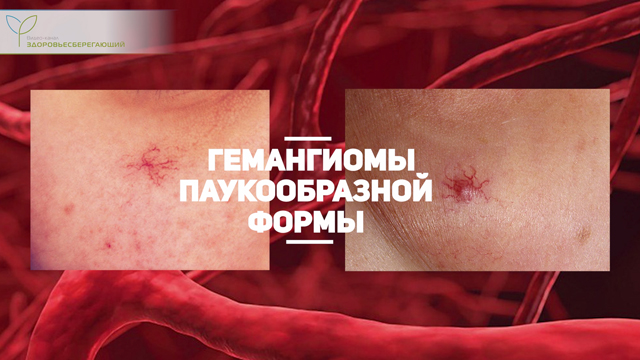 Что такое печеночная пигментация. Смотреть фото Что такое печеночная пигментация. Смотреть картинку Что такое печеночная пигментация. Картинка про Что такое печеночная пигментация. Фото Что такое печеночная пигментация