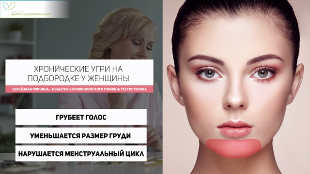 Угри на подпородке