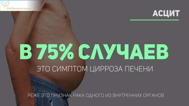 Симптом цирроза печени
