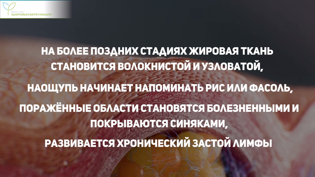 Хронический застой лимфы